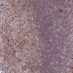 PKC eta Antibody, Novus Biologicals 0.1mL; Unlabeled:Antibodies, Polyclonal