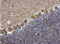 PKC gamma Antibody, Novus Biologicals 100 &mu;L | Buy Online | Novus Biologicals | Fisher Scientific