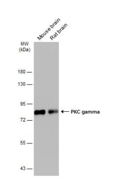 PKC gamma Antibody, Novus Biologicals 100 &mu;L | Buy Online | Novus Biologicals | Fisher Scientific