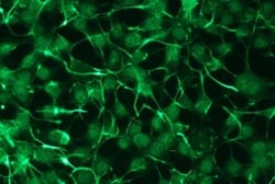 Rabbit anti-PKC zeta, Clone: R14-K, Novus Biologicals 0.05mL; Unlabeled:Antibodies,