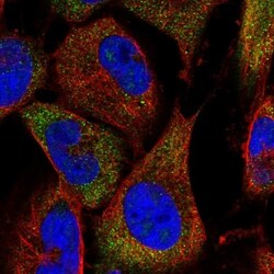 PKDREJ Antibody, Novus Biologicals 0.1mL; Unlabeled:Antibodies, Polyclonal