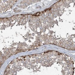 PKDREJ Antibody, Novus Biologicals 0.1mL; Unlabeled:Antibodies, Polyclonal
