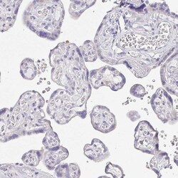 PKDREJ Antibody, Novus Biologicals 0.1mL; Unlabeled:Antibodies, Polyclonal