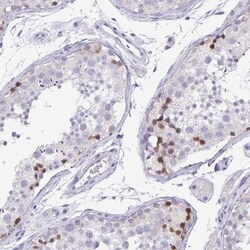 PKDREJ Antibody, Novus Biologicals 0.1mL; Unlabeled:Antibodies, Polyclonal
