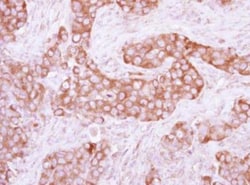 PKLR Antibody, Novus Biologicals 0.1mL; Unlabeled:Antibodies, Polyclonal