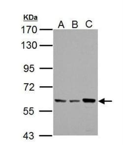 PKLR Antibody, Novus Biologicals 0.1mL; Unlabeled:Antibodies, Polyclonal