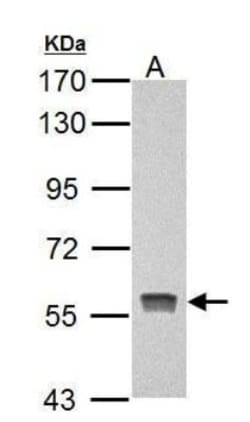 PKLR Antibody, Novus Biologicals 0.1mL; Unlabeled:Antibodies, Polyclonal