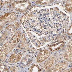 PKN1 Antibody, Novus Biologicals 0.1mL; Unlabeled:Antibodies, Polyclonal