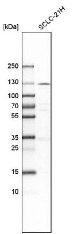 PKN1 Antibody, Novus Biologicals 0.1mL; Unlabeled:Antibodies, Polyclonal