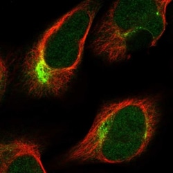 PKN2 Antibody, Novus Biologicals 25 &mu;L, Unlabeled:Antibodies, Polyclonal