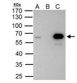 PKNOX1 Antibody, Novus Biologicals 0.1mL; Unlabeled:Antibodies, Polyclonal