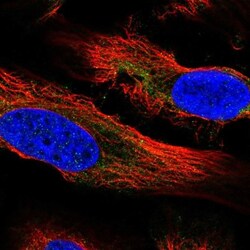 PLA2G1B Antibody, Novus Biologicals:Antibodies:Primary Antibodies