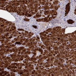 PLA2G1B Antibody, Novus Biologicals:Antibodies:Primary Antibodies