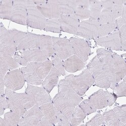 PLA2G1B Antibody, Novus Biologicals:Antibodies:Primary Antibodies