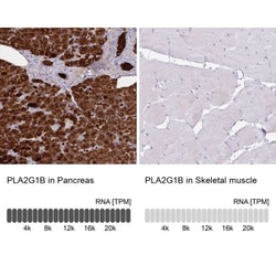 PLA2G1B Antibody, Novus Biologicals:Antibodies:Primary Antibodies