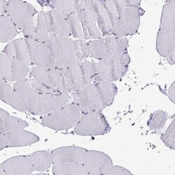 PLA2G1B Antibody, Novus Biologicals:Antibodies:Primary Antibodies