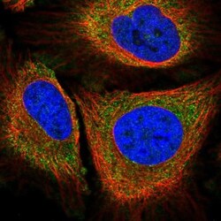 PLA2G4A Antibody, Novus Biologicals:Antibodies:Primary Antibodies