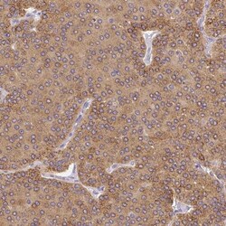 PLA2G4A Antibody, Novus Biologicals:Antibodies:Primary Antibodies
