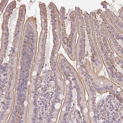 PLA2G4F Antibody, Novus Biologicals 25 &mu;L, Unlabeled:Antibodies, Polyclonal
