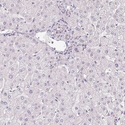 PLA2G4F Antibody, Novus Biologicals 25 &mu;L, Unlabeled:Antibodies, Polyclonal