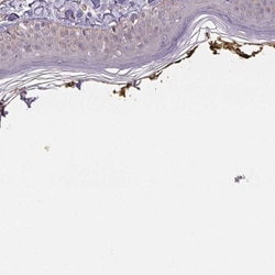 PLA2G4F Antibody, Novus Biologicals 25 &mu;L, Unlabeled:Antibodies, Polyclonal