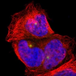 PLA2G6 Antibody, Novus Biologicals:Antibodies:Primary Antibodies