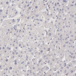 PLA2G6 Antibody, Novus Biologicals:Antibodies:Primary Antibodies