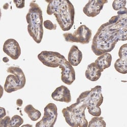 PLA2G6 Antibody, Novus Biologicals:Antibodies:Primary Antibodies