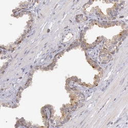 PLA2G6 Antibody, Novus Biologicals:Antibodies:Primary Antibodies