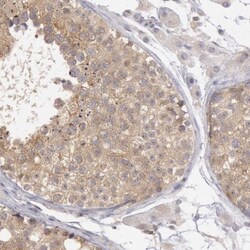 PLA2G6 Antibody, Novus Biologicals:Antibodies:Primary Antibodies
