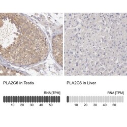 PLA2G6 Antibody, Novus Biologicals:Antibodies:Primary Antibodies
