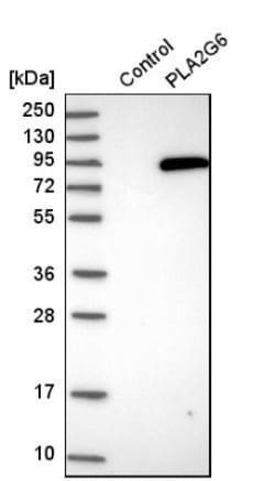 PLA2G6 Antibody, Novus Biologicals:Antibodies:Primary Antibodies