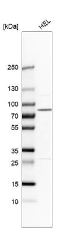 PLA2G6 Antibody, Novus Biologicals:Antibodies:Primary Antibodies