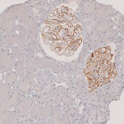 PLA2R1 Antibody, Novus Biologicals:Antibodies:Primary Antibodies