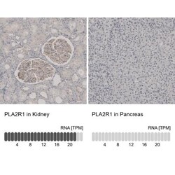 PLA2R1 Antibody, Novus Biologicals:Antibodies:Primary Antibodies