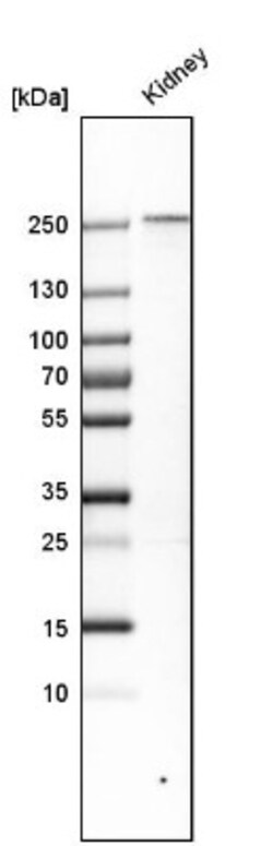 PLA2R1 Antibody, Novus Biologicals:Antibodies:Primary Antibodies