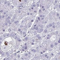 PLAC1L Antibody, Novus Biologicals 25 &mu;L, Unlabeled:Antibodies, Polyclonal