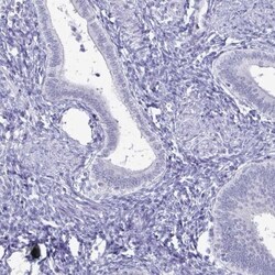 PLAC1L Antibody, Novus Biologicals 25 &mu;L, Unlabeled:Antibodies, Polyclonal