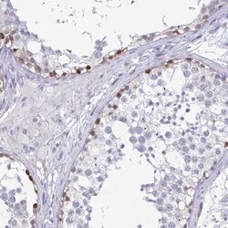 PLAC1L Antibody, Novus Biologicals 25 &mu;L, Unlabeled:Antibodies, Polyclonal