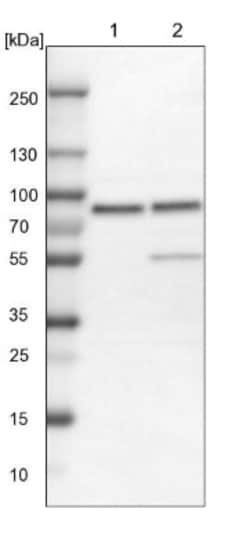 PLAP Antibody, Novus Biologicals 0.1mL; Unlabeled:Anticuerpos