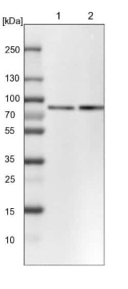 PLAP Antibody, Novus Biologicals:Antibodies:Primary Antibodies