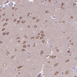 PLC-beta 1 Antibody, Novus Biologicals 0.1mL; Unlabeled:Antibodies, Polyclonal