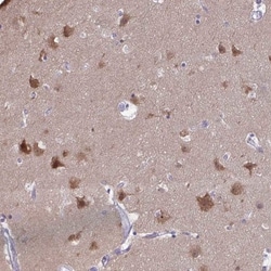 PLC-beta 1 Antibody, Novus Biologicals 0.1mL; Unlabeled:Antibodies, Polyclonal