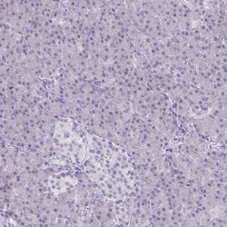PLC-beta 1 Antibody, Novus Biologicals 0.1mL; Unlabeled:Antibodies, Polyclonal