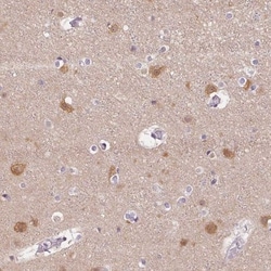 PLC-beta 1 Antibody, Novus Biologicals:Antibodies:Primary Antibodies