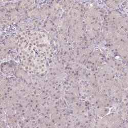 PLC-beta 1 Antibody, Novus Biologicals:Antibodies:Primary Antibodies