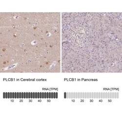 PLC-beta 1 Antibody, Novus Biologicals:Antibodies:Primary Antibodies