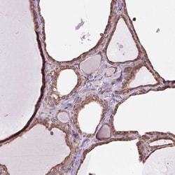 PLC-gamma 1 Antibody, Novus Biologicals 25 &mu;L, Unlabeled:Antibodies,