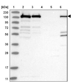 PLC-gamma 1 Antibody, Novus Biologicals 0.1mL; Unlabeled:Antibodies, Polyclonal