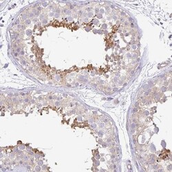 PLCD4 Antibody, Novus Biologicals 0.1mL; Unlabeled:Antibodies, Polyclonal